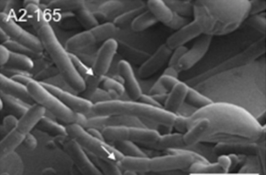 Faecalibacterium Praustnizii și efectul antiinflamator asupra organismului